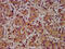 ADAM Metallopeptidase Domain 23 antibody, CSB-PA001285LA01HU, Cusabio, Immunohistochemistry paraffin image 