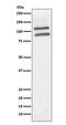 Promyelocytic Leukemia antibody, M00093, Boster Biological Technology, Western Blot image 