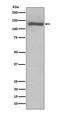 Toll Like Receptor 7 antibody, M00376, Boster Biological Technology, Western Blot image 