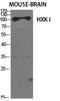 Hexokinase 1 antibody, STJ93630, St John