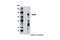 EPH Receptor B6 antibody, 12560S, Cell Signaling Technology, Western Blot image 