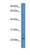 Carbonyl Reductase 4 antibody, NBP1-79860, Novus Biologicals, Western Blot image 