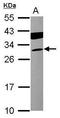Troponin I3, Cardiac Type antibody, GTX113028, GeneTex, Western Blot image 