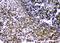 c-Myc antibody, PB9092, Boster Biological Technology, Immunohistochemistry paraffin image 