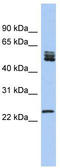 Serine And Arginine Rich Splicing Factor 7 antibody, TA336041, Origene, Western Blot image 