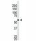 Beta-Secretase 2 antibody, F40129-0.4ML, NSJ Bioreagents, Western Blot image 