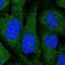 Dedicator Of Cytokinesis 6 antibody, NBP2-33565, Novus Biologicals, Immunofluorescence image 