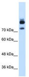 Myotubularin Related Protein 1 antibody, TA346366, Origene, Western Blot image 