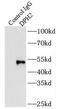Diphthamide Biosynthesis 2 antibody, FNab02516, FineTest, Immunoprecipitation image 