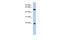 Crystallin Gamma C antibody, 31-293, ProSci, Western Blot image 