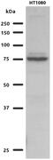 Glutamine-Fructose-6-Phosphate Transaminase 2 antibody, 15189-1-AP, Proteintech Group, Western Blot image 