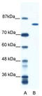 DEAH-Box Helicase 16 antibody, TA331470, Origene, Western Blot image 