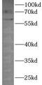 Purinergic Receptor P2X 4 antibody, FNab10076, FineTest, Western Blot image 