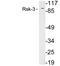 Ribosomal Protein S6 Kinase A2 antibody, LS-C199990, Lifespan Biosciences, Western Blot image 