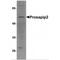 TBK1 Binding Protein 1 antibody, MBS150792, MyBioSource, Western Blot image 