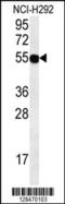 Zinc Finger Protein 492 antibody, 55-296, ProSci, Western Blot image 