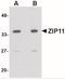 Solute Carrier Family 39 Member 11 antibody, NBP1-77344, Novus Biologicals, Western Blot image 