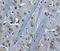 Bruton Tyrosine Kinase antibody, NBP1-76596, Novus Biologicals, Immunohistochemistry paraffin image 