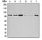 Glycogen Synthase 1 antibody, orb214028, Biorbyt, Western Blot image 