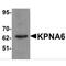 Karyopherin Subunit Alpha 6 antibody, MBS150717, MyBioSource, Western Blot image 