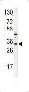 Insulin Like Growth Factor Binding Protein 3 antibody, PA5-14660, Invitrogen Antibodies, Western Blot image 