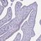 Gasdermin B antibody, NBP2-33648, Novus Biologicals, Immunohistochemistry paraffin image 