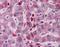 Acid Phosphatase 2, Lysosomal antibody, A06554, Boster Biological Technology, Immunohistochemistry paraffin image 