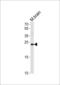 Tumor protein D52 antibody, LS-B13972, Lifespan Biosciences, Western Blot image 