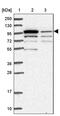 Poly(ADP-Ribose) Polymerase Family Member 8 antibody, PA5-61905, Invitrogen Antibodies, Western Blot image 