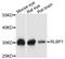 Retinaldehyde Binding Protein 1 antibody, STJ111562, St John