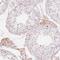 Complement Factor H Related 2 antibody, PA5-62054, Invitrogen Antibodies, Immunohistochemistry paraffin image 