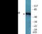 Checkpoint Kinase 2 antibody, EKC2374, Boster Biological Technology, Western Blot image 