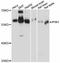 Inositol Hexakisphosphate Kinase 1 antibody, LS-C747378, Lifespan Biosciences, Western Blot image 