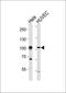 Histone Deacetylase 6 antibody, orb256587, Biorbyt, Western Blot image 