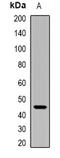 IGL@ protein antibody, orb388300, Biorbyt, Western Blot image 