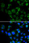 Microtubule Associated Protein RP/EB Family Member 2 antibody, 22-378, ProSci, Immunofluorescence image 