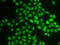 Ubiquitin Conjugating Enzyme E2 V1 antibody, LS-B13894, Lifespan Biosciences, Immunofluorescence image 