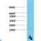 Transthyretin antibody, LS-C813254, Lifespan Biosciences, Western Blot image 