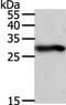 Spindlin Family Member 2A antibody, PA5-50266, Invitrogen Antibodies, Western Blot image 