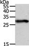 Spindlin Family Member 2A antibody, PA5-50266, Invitrogen Antibodies, Western Blot image 