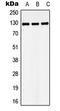 Large Tumor Suppressor Kinase 1 antibody, LS-C353799, Lifespan Biosciences, Western Blot image 