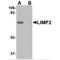 Scavenger Receptor Class B Member 2 antibody, MBS150945, MyBioSource, Western Blot image 