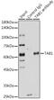 TGF-Beta Activated Kinase 1 (MAP3K7) Binding Protein 1 antibody, GTX33533, GeneTex, Immunoprecipitation image 