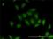 Serine/Threonine Kinase 26 antibody, H00051765-M01, Novus Biologicals, Immunocytochemistry image 