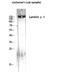 Laminin Subunit Gamma 1 antibody, STJ93896, St John