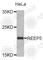 Receptor Accessory Protein 5 antibody, A4191, ABclonal Technology, Western Blot image 