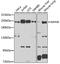 Myosin Heavy Chain 9 antibody, 13-066, ProSci, Western Blot image 