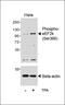 Eukaryotic Elongation Factor 2 Kinase antibody, M02277, Boster Biological Technology, Western Blot image 