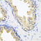 Serine Peptidase Inhibitor, Kunitz Type 2 antibody, abx005176, Abbexa, Western Blot image 