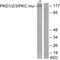 Protein Kinase D1 antibody, PA5-38387, Invitrogen Antibodies, Western Blot image 